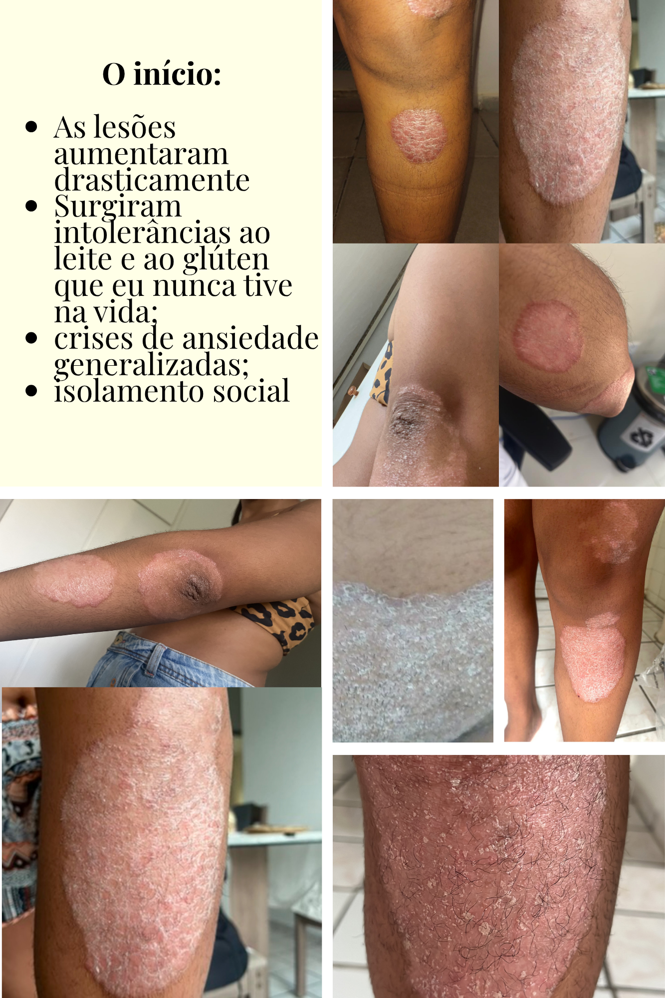 As lesões aumentaram: intolerâncias, ansiedade e isolamento social