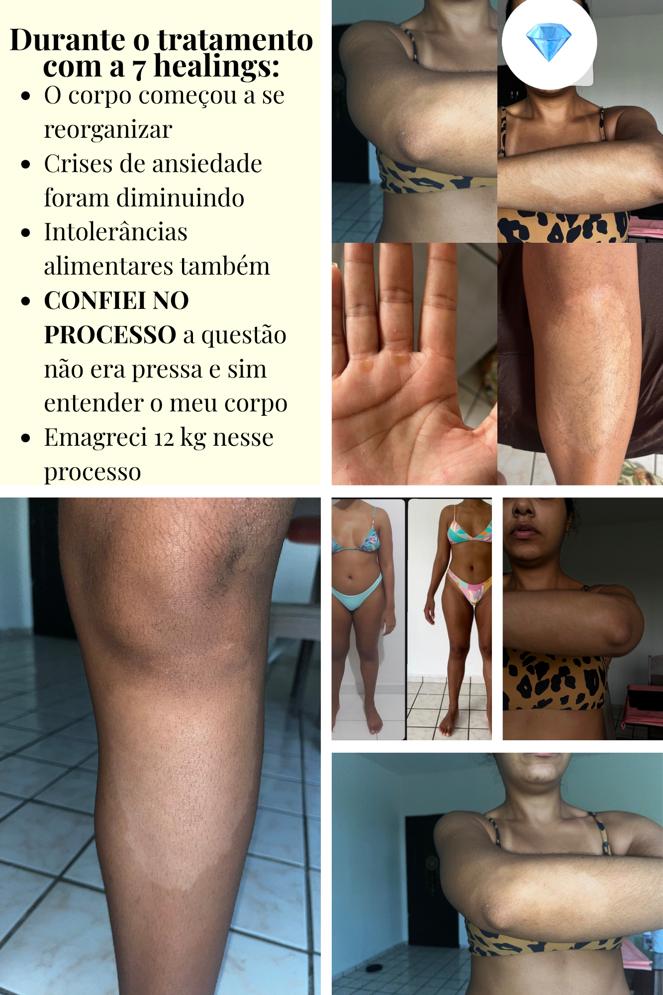 Durante o tratamento com a 7 Healings: o corpo começou a se reorganizar